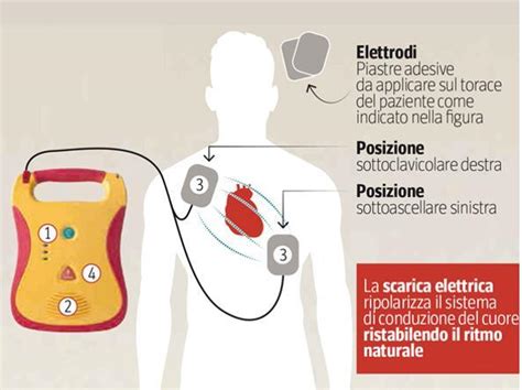 Schema dei soccorsi e utilizzo del defibrillatore durante l'evento
