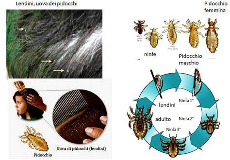 Grafico sulla diffusione dei pidocchi