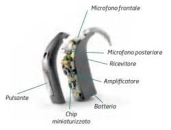 Schema funzionamento apparecchio acustico
