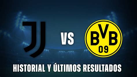 Grafico quote scommesse Juventus vs. Borussia Dortmund